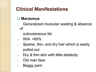Clinical Manifestations
 Marasmus
o Generalized muscular wasting & absence
of
subcutaneous fat
o W/A <60%
o Sparse, thin, and dry hair which is easily
pulled out
o Dry & thin skin with little elasticity
o Old man face
o Baggy pant
 