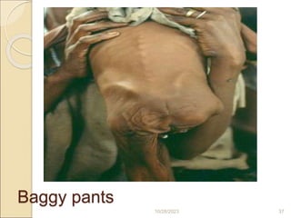 Baggy pants
10/28/2023 37
 