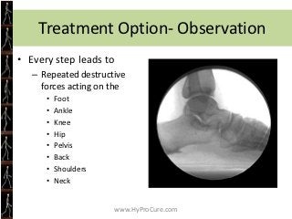Feet are the foundation to the body.




            www.HyProCure.com
 