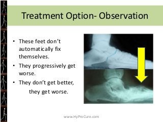 They Suffer When They Exercise

• 4 to 5 times your body weight
  travels through each foot when
  walking and up to 10 ti...
