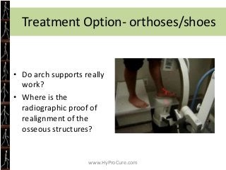 TaloTarsal Dislocation Syndrome
•   Did you know the average person takes
•   7,000 steps/day
•   49,000 steps/week
•   19...