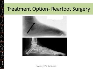 Finally, most people will just give up

• Why keep torturing yourself?

• You are rewarded with pain.

Increased activity ...