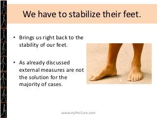 Who is not a candidate for EOTTS

• Rigid deformity
• Less than three (3) years of age




                   www.HyProCur...