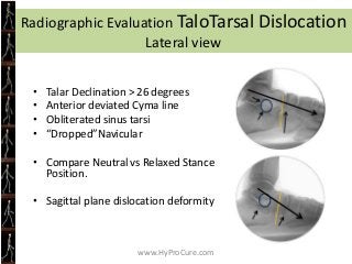 Obesity Treatment

Did you know:
• Only 21% of 64 obesity programs resulted
  in a short-term weight-loss
• Of that 21%, i...