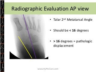 Obesity Treatment


• Decreased food intake
• Increase weightbearing activity
• Decrease sedentary behavior




          ...
