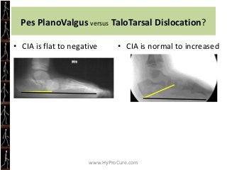 Exercise is important to maintaining
          proper body weight.
Exercise leads to increased metabolism
        and decr...