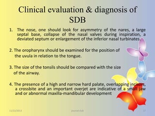 Clinical evaluation & diagnosis of
SDB
1. The nose, one should look for asymmetry of the nares, a large
septal base, collapse of the nasal valves during inspiration, a
deviated septum or enlargement of the inferior nasal turbinates.
2. The oropharynx should be examined for the position of
the uvula in relation to the tongue.

3. The size of the tonsils should be compared with the size
of the airway.
4. The presence of a high and narrow hard palate, overlapping incisors,
a crossbite and an important overjet are indicative of a small jaw
and or abnormal maxilla-mandibular development

11/22/2013

journal club

17

 