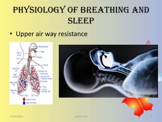 Physiology of breathing and
sleep
• Upper air way resistance

11/22/2013

journal club

7

 