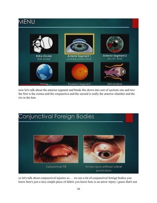 16
now let's talk about the anterior segment and break this down into sort of sections one and two
the first is the cornea and the conjunctiva and the second is really the anterior chamber and the
iris in the lens
so let's talk about conjunctival injuries so… we see a lot of conjunctival foreign bodies you
know here's just a nice simple piece of debris you know here is an arrow injury i guess that's not
 