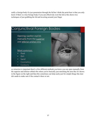 17
really a foreign body it's just penetration through the lid but i think the point here is that you only
know if there is a true foreign body if you can effectively evert the lid so this shows two
techniques of just grabbing the lid and inverting around your finger
so retraction is important there's a few different methods you know you can open manually from
the superior and inferior orbital ribs where you're basically just stretching the area like it's shown
in the figure on the right and then this sometimes can help easily just for simple things like dust
dirt sands to make sure if the contact's there or not.
 