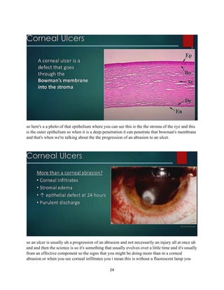 24
so here's a a photo of that epithelium where you can see this is the the stroma of the eye and this
is the outer epithelium so when it is a deep penetration it can penetrate that bowman's membrane
and that's when we're talking about the the progression of an abrasion to an ulcer.
so an ulcer is usually uh a progression of an abrasion and not necessarily an injury all at once uh
and and then the science is so it's something that usually evolves over a little time and it's usually
from an effective component so the signs that you might be doing more than in a corneal
abrasion or when you see corneal infiltrates you i mean this is without a fluorescent lamp you
 