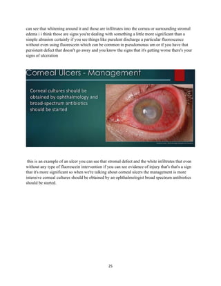 25
can see that whitening around it and those are infiltrates into the cornea or surrounding stromal
edema i i think those are signs you're dealing with something a little more significant than a
simple abrasion certainly if you see things like purulent discharge a particular fluorescence
without even using fluorescein which can be common in pseudomonas um or if you have that
persistent defect that doesn't go away and you know the signs that it's getting worse there's your
signs of ulceration
this is an example of an ulcer you can see that stromal defect and the white infiltrates that even
without any type of fluorescein intervention if you can see evidence of injury that's that's a sign
that it's more significant so when we're talking about corneal ulcers the management is more
intensive corneal cultures should be obtained by an ophthalmologist broad spectrum antibiotics
should be started.
 