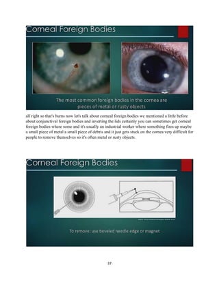 37
all right so that's burns now let's talk about corneal foreign bodies we mentioned a little before
about conjunctival foreign bodies and inverting the lids certainly you can sometimes get corneal
foreign bodies where some and it's usually an industrial worker where something fires up maybe
a small piece of metal a small piece of debris and it just gets stuck on the cornea very difficult for
people to remove themselves so it's often metal or rusty objects.
 