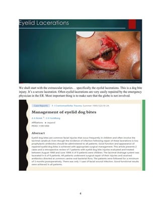 4
We shall start with the extraocular injuries… specifically the eyelid lacerations. This is a dog bite
injury. It’s a severe laceration. Often eyelid lacerations are very easily repaired by the emergency
physician in the ER. Most important thing is to make sure that the globe is not involved.
 