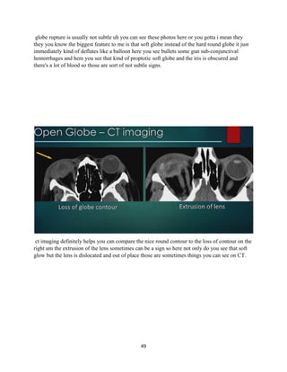 49
globe rupture is usually not subtle uh you can see these photos here or you gotta i mean they
they you know the biggest feature to me is that soft globe instead of the hard round globe it just
immediately kind of deflates like a balloon here you see bullets some gun sub-conjunctival
hemorrhages and here you see that kind of proptotic soft globe and the iris is obscured and
there's a lot of blood so those are sort of not subtle signs.
ct imaging definitely helps you can compare the nice round contour to the loss of contour on the
right um the extrusion of the lens sometimes can be a sign so here not only do you see that soft
glow but the lens is dislocated and out of place those are sometimes things you can see on CT.
 