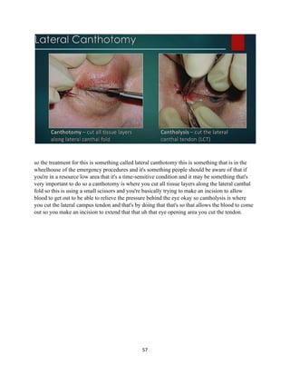 57
so the treatment for this is something called lateral canthotomy this is something that is in the
wheelhouse of the emergency procedures and it's something people should be aware of that if
you're in a resource low area that it's a time-sensitive condition and it may be something that's
very important to do so a canthotomy is where you cut all tissue layers along the lateral canthal
fold so this is using a small scissors and you're basically trying to make an incision to allow
blood to get out to be able to relieve the pressure behind the eye okay so cantholysis is where
you cut the lateral campus tendon and that's by doing that that's so that allows the blood to come
out so you make an incision to extend that that uh that eye opening area you cut the tendon.
 