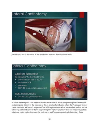 58
you have access to the inside of the retrobulbar area and then blood can drain.
so this is an example it's the opposite eye but an incision is made along the edge and then blood
is draining and it relieves the pressure so this is absolutely indicated when there's an acute loss of
vision increased IOP there's proptosis if the IOP is greater than 40 an unconscious patient um it's
relatively contraindicated if there's suspected globe rupture you know this is where your globe is
intact and you're trying to protect the optic nerve so if you can consult ophthalmology that's
 