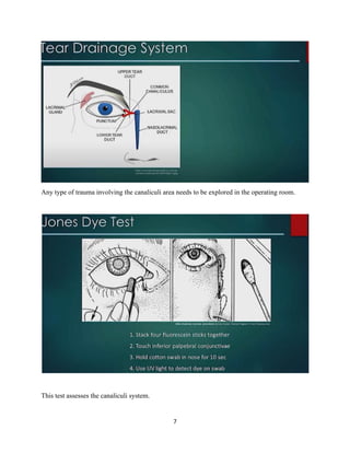 7
Any type of trauma involving the canaliculi area needs to be explored in the operating room.
This test assesses the canaliculi system.
 