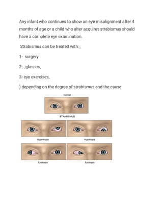 Any infant who continues to show an eye misalignment after 4
months of age or a child who alter acquires strabismus should
have a complete eye examination.
Strabismus can be treated with:_
1- surgery
2- , glasses,
3- eye exercises,
) depending on the degree of strabismus and the cause.
 