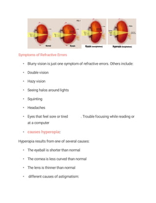 Symptoms of Refractive Errors
• Blurry vision is just one symptom of refractive errors. Others include:
• Double vision
• Hazy vision
• Seeing halos around lights
• Squinting
• Headaches
• Eyes that feel sore or tired . Trouble focusing while reading or
at a computer
• causes hyperopia:
Hyperopia results from one of several causes:
• The eyeball is shorter than normal
• The cornea is less curved than normal
• The lens is thinner than normal
• different causes of astigmatism:
 
