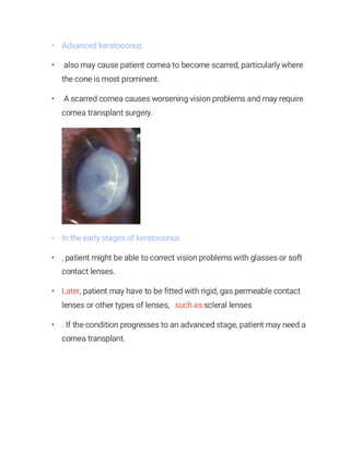• Advanced keratoconus
• also may cause patient cornea to become scarred, particularly where
the cone is most prominent.
• A scarred cornea causes worsening vision problems and may require
cornea transplant surgery.
• In the early stages of keratoconus
• , patient might be able to correct vision problems with glasses or soft
contact lenses.
• Later, patient may have to be fitted with rigid, gas permeable contact
lenses or other types of lenses, such as scleral lenses
• . If the condition progresses to an advanced stage, patient may need a
cornea transplant.
 