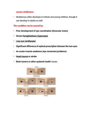 causes strabismus:
• Strabismus often develops in infants and young children, though it
can develop in adults as well.
The condition can be caused by:
• Poor development of eye coordination (binocular vision)
• Severe farsightedness (hyperopia)
• Lazy eye (amblyopia)
• Significant difference of optical prescription between the two eyes
• An ocular muscle weakness (eye movement problems)
• Head trauma or stroke
• Brain tumors or other systemic health issues
 