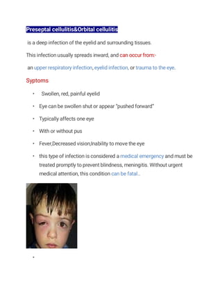 Preseptal cellulitis&Orbital cellulitis
is a deep infection of the eyelid and surrounding tissues.
This infection usually spreads inward, and can occur from:-
an upper respiratory infection, eyelid infection, or trauma to the eye.
Syptoms
• Swollen, red, painful eyelid
• Eye can be swollen shut or appear “pushed forward”
• Typically affects one eye
• With or without pus
• Fever,Decreased vision,Inability to move the eye
• this type of infection is considered a medical emergency and must be
treated promptly to prevent blindness, meningitis. Without urgent
medical attention, this condition can be fatal..
•
 