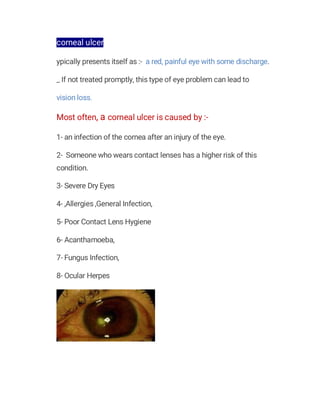 corneal ulcer
ypically presents itself as :- a red, painful eye with some discharge.
_ If not treated promptly, this type of eye problem can lead to
vision loss.
Most often, a corneal ulcer is caused by :-
1- an infection of the cornea after an injury of the eye.
2- Someone who wears contact lenses has a higher risk of this
condition.
3- Severe Dry Eyes
4- ,Allergies ,General Infection,
5- Poor Contact Lens Hygiene
6- Acanthamoeba,
7- Fungus Infection,
8- Ocular Herpes
 