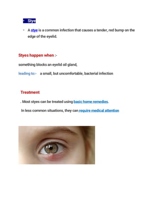• Stye
• A stye is a common infection that causes a tender, red bump on the
edge of the eyelid.
Styes happen when :-
something blocks an eyelid oil gland,
leading to:- a small, but uncomfortable, bacterial infection
Treatment
. Most styes can be treated using basic home remedies.
In less common situations, they can require medical attention
 
