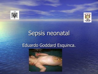 Sepsis neonatal Eduardo Goddard Esquinca. 