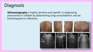 Ultrasonography is highly sensitive and specific in diagnosing
pneumonia in children by determining lung consolidations and air
bronchograms or effusions.
Diagnosis
 