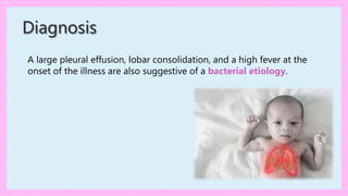 A large pleural effusion, lobar consolidation, and a high fever at the
onset of the illness are also suggestive of a bacterial etiology.
Diagnosis
 