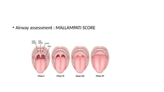 PEDIATRIC PROCEDURAL SEDATION AND ANALGESIA.pptx