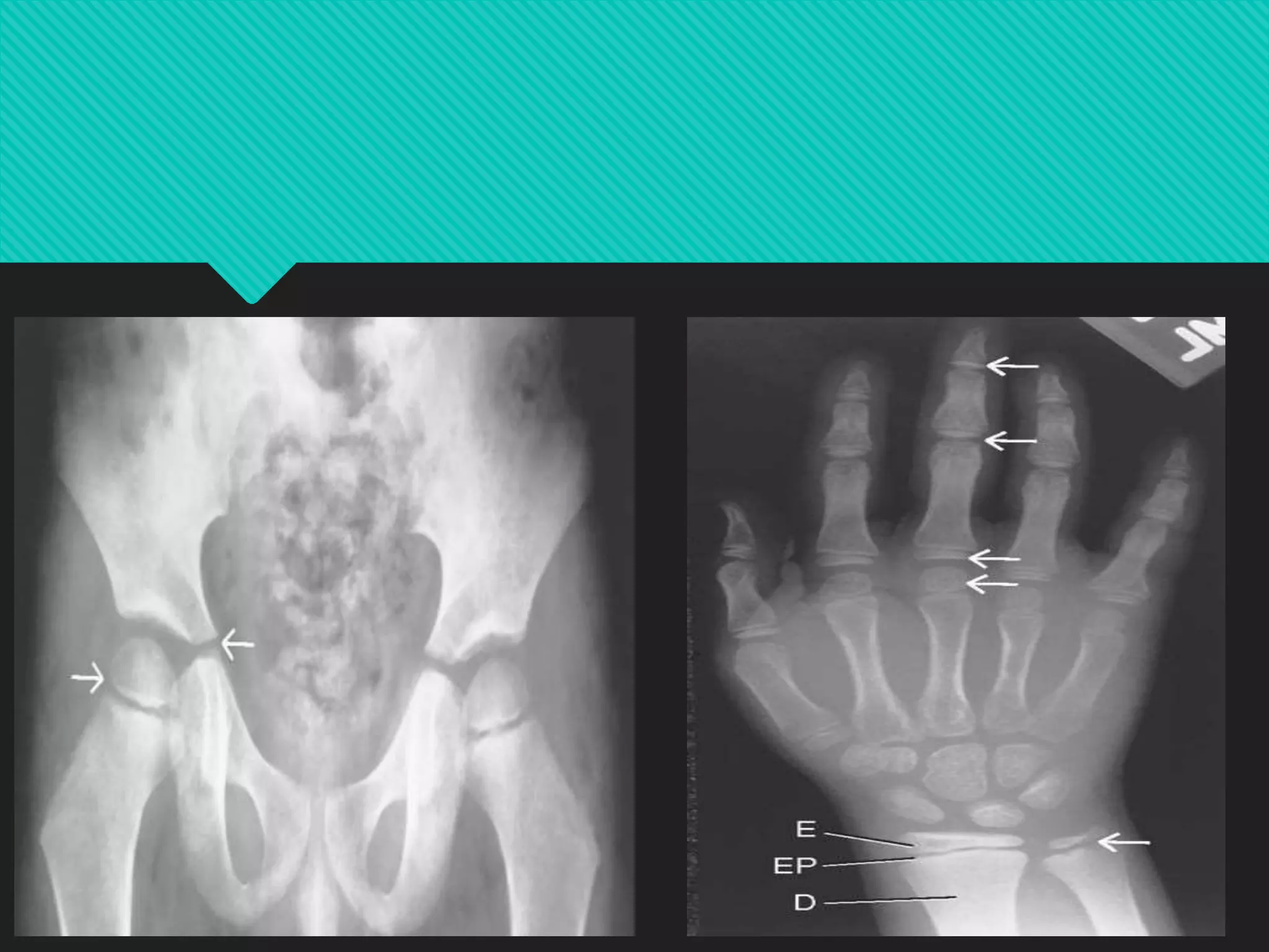 PEDIATRIC RADIOGRAPHY.pptx
