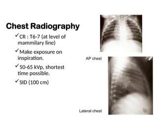 PEDIATRIC RADIOGRAPHY MEDICAL IMAGING.ppt