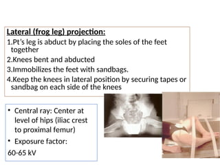 PEDIATRIC RADIOGRAPHY MEDICAL IMAGING.ppt