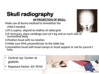 Moore Method Positioning Radiography PEDIATRIC RADIOGRAPHY MEDICAL IMAGING.ppt