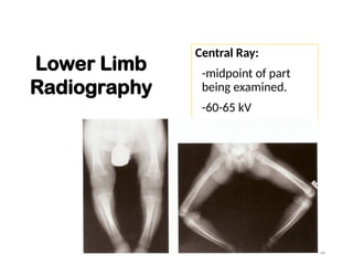 PEDIATRIC RADIOGRAPHY MEDICAL IMAGING.ppt