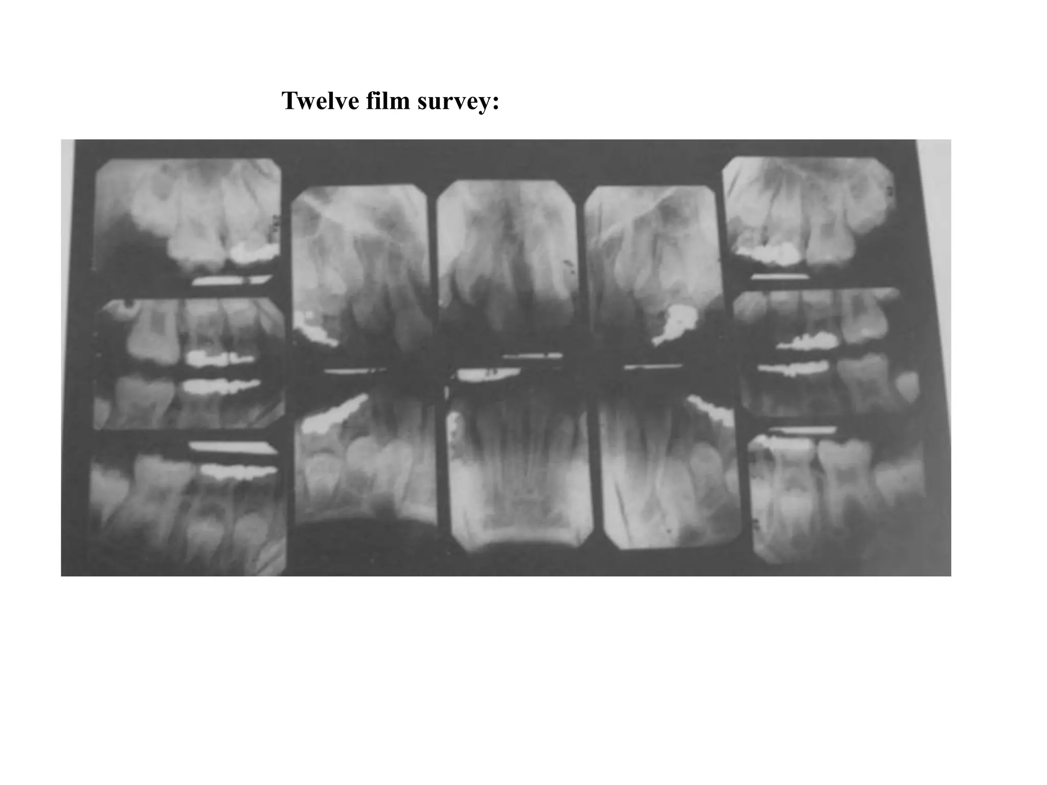 Radiology in Pediatric Dentistry | PPTX