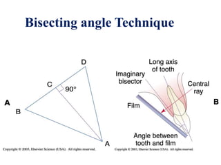 Bisecting angle Technique
 