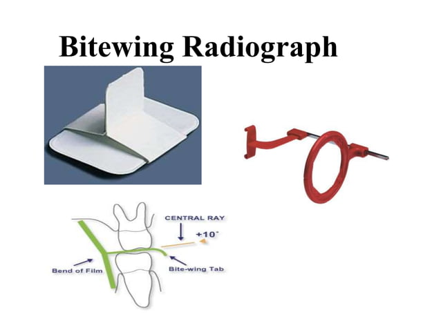 Bitewing Sticker Radiology in Pediatric Dentistry | PPTX