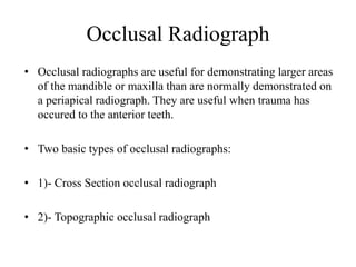 Occlusal Radiograph
• Occlusal radiographs are useful for demonstrating larger areas
of the mandible or maxilla than are normally demonstrated on
a periapical radiograph. They are useful when trauma has
occured to the anterior teeth.
• Two basic types of occlusal radiographs:
• 1)- Cross Section occlusal radiograph
• 2)- Topographic occlusal radiograph
 