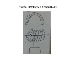 CROSS SECTION RADIOGRAPH
 