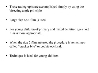 • These radiographs are accomplished simply by using the
bisecting angle principle
• Large size no.4 film is used
• For young children of primary and mixed dentition ages no.2
film is more appropriate.
• When the size 2 film are used the procedure is sometimes
called “cracker bite” or cookie occlusal.
• Technique is ideal for young children
 