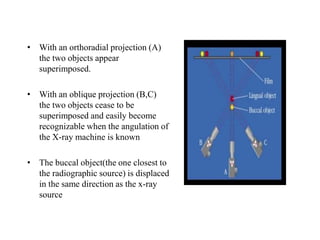 • With an orthoradial projection (A)
the two objects appear
superimposed.
• With an oblique projection (B,C)
the two objects cease to be
superimposed and easily become
recognizable when the angulation of
the X-ray machine is known
• The buccal object(the one closest to
the radiographic source) is displaced
in the same direction as the x-ray
source
 