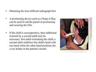 • Obtaining the least difficult radiograph first
• A positioning device such as a Snap-A-Ray
can be used to aid the parent in positioning
and securing the film
• If the child is uncooperative, then additional
restraint by a second adult may be
necessary. first adult restraining the child, a
second adult stabilizes the child's head with
one hand while the other hand positions the
x-ray holder in the patient's mouth.
 