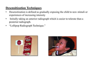 Desensitization Techniques
• Desensitization is defined as gradually exposing the child to new stimuli or
experiences of increasing intensity
• Initially taking an anterior radiograph which is easier to tolerate than a
posterior radiograph.
• “Lollipop Radiograph Technique.”
 