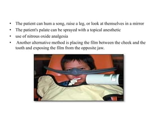• The patient can hum a song, raise a leg, or look at themselves in a mirror
• The patient's palate can be sprayed with a topical anesthetic
• use of nitrous oxide analgesia
• Another alternative method is placing the film between the cheek and the
tooth and exposing the film from the opposite jaw.
 