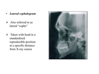 • Lateral cephalogram
 Also referred to as
lateral “cephs”
 Taken with head in a
standardized
reproducible position
at a specific distance
from X-ray source
 