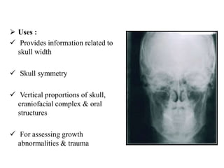  Uses :
 Provides information related to
skull width
 Skull symmetry
 Vertical proportions of skull,
craniofacial complex & oral
structures
 For assessing growth
abnormalities & trauma
 
